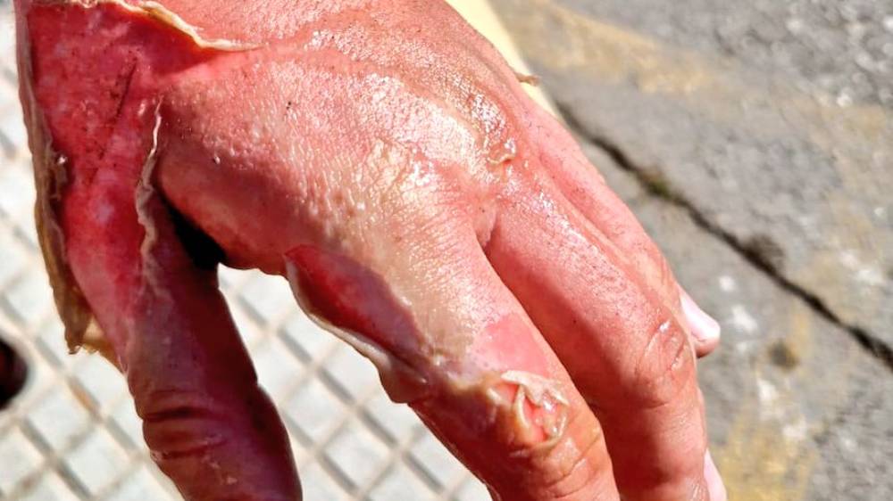 Incendio en Tomares: el error doméstico que los bomberos advierten evitar a toda costa